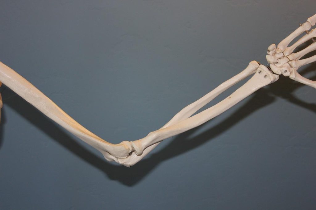 Chiropractie behandeling voor radiuskopfractuur herstel met gerichte aanpassingen en oefeningen